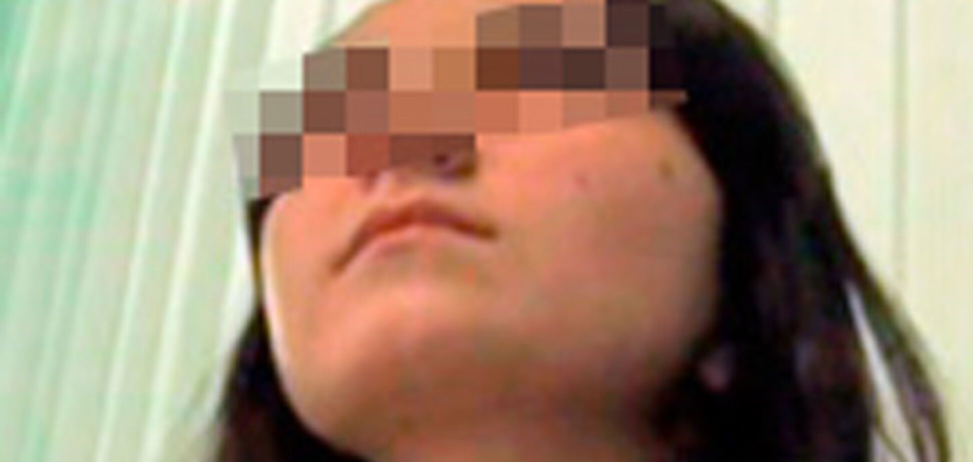 Трое детей в реанимации из-за сгоревшей елки