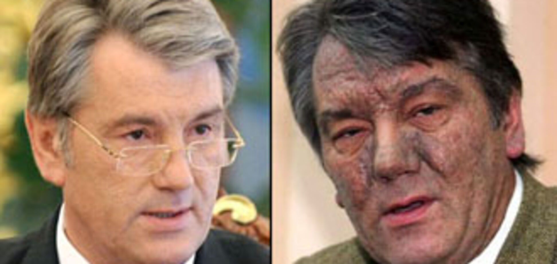 Москаль об отравлении Ющенко: 'Жрать надо меньше…'