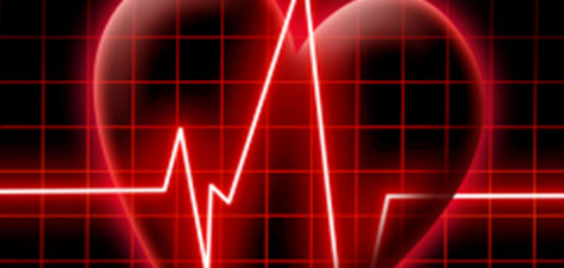 Каждый должен знать. Первая помощь при остановке сердца