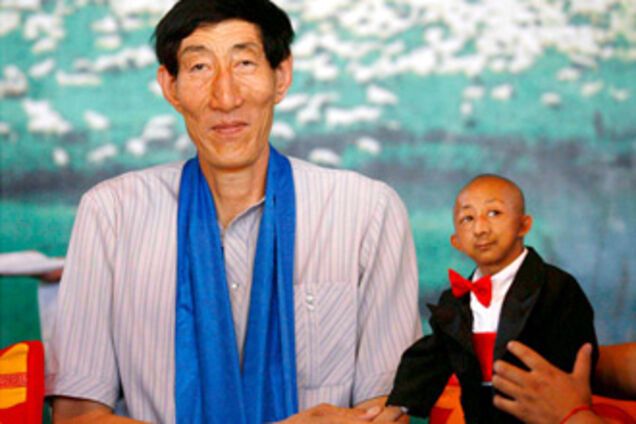 Скончался самый маленький человек в мире. ФОТО