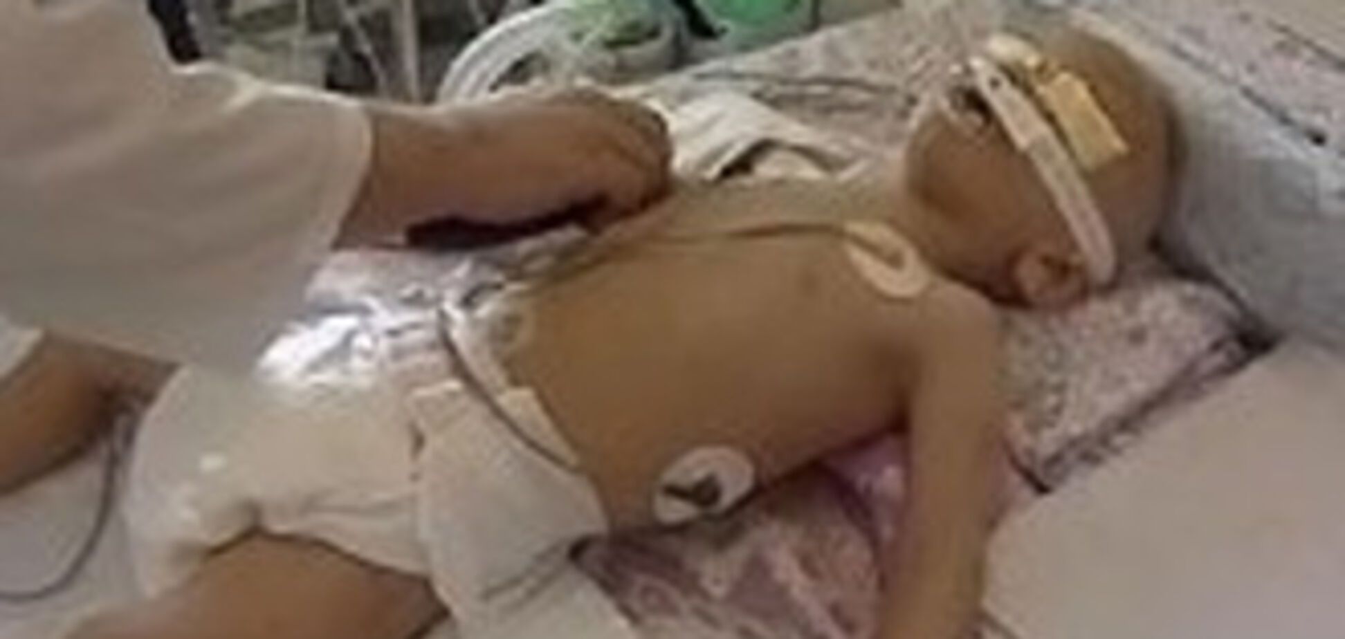 Скончался двухлетний ребенок, избитый родителями