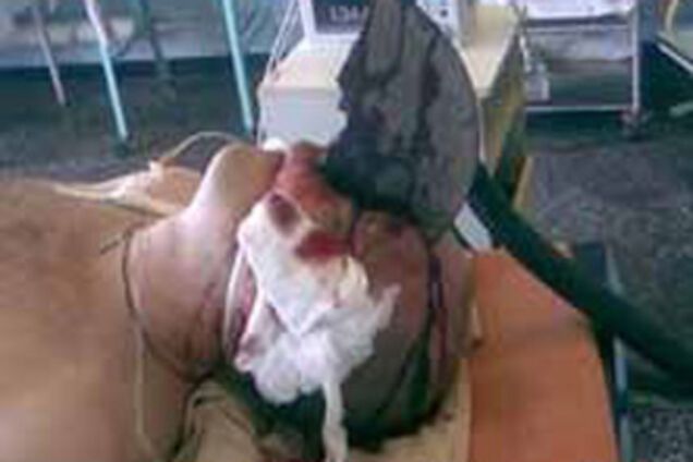 Учитель труда попал в больницу с болгаркой в голове. ФОТО