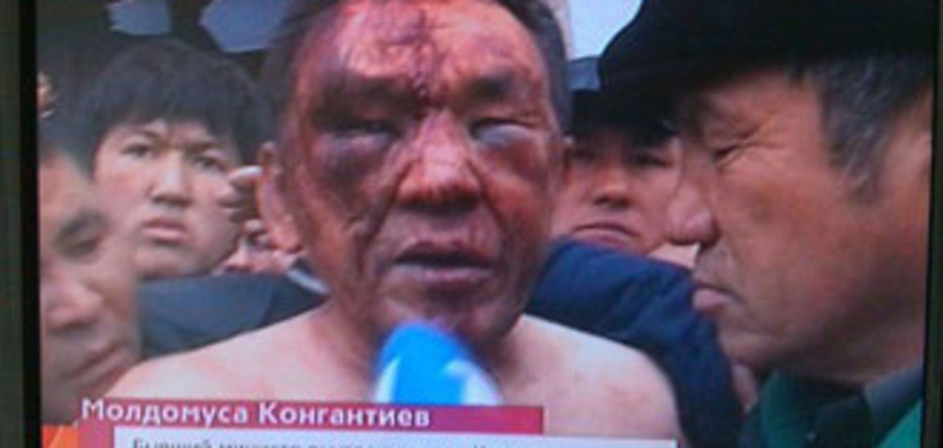 ФОТО дня. Избитый повстанцами бывший министр МВД Киргизии