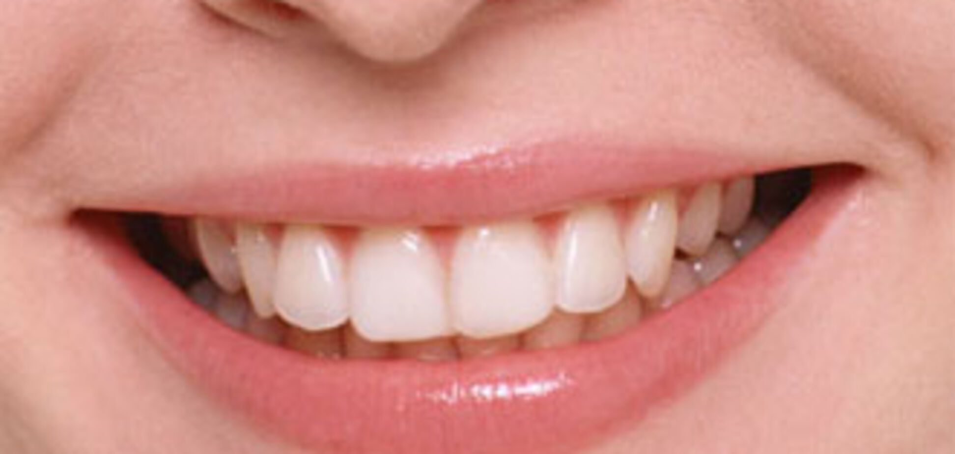 Кубинський консул покусав фотографа