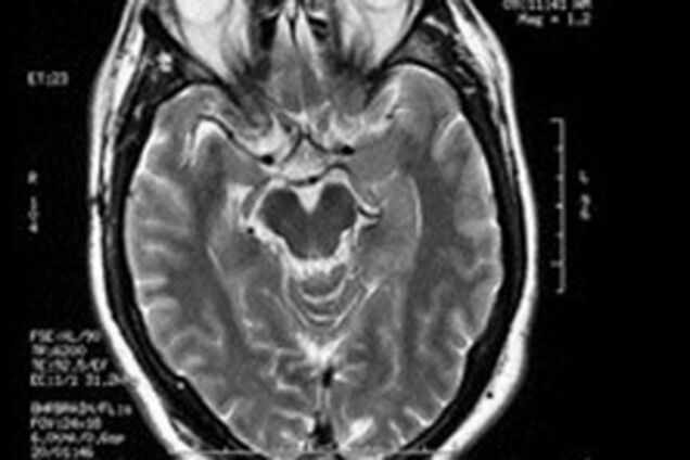 Если вы очень долго думаете – вы гений!