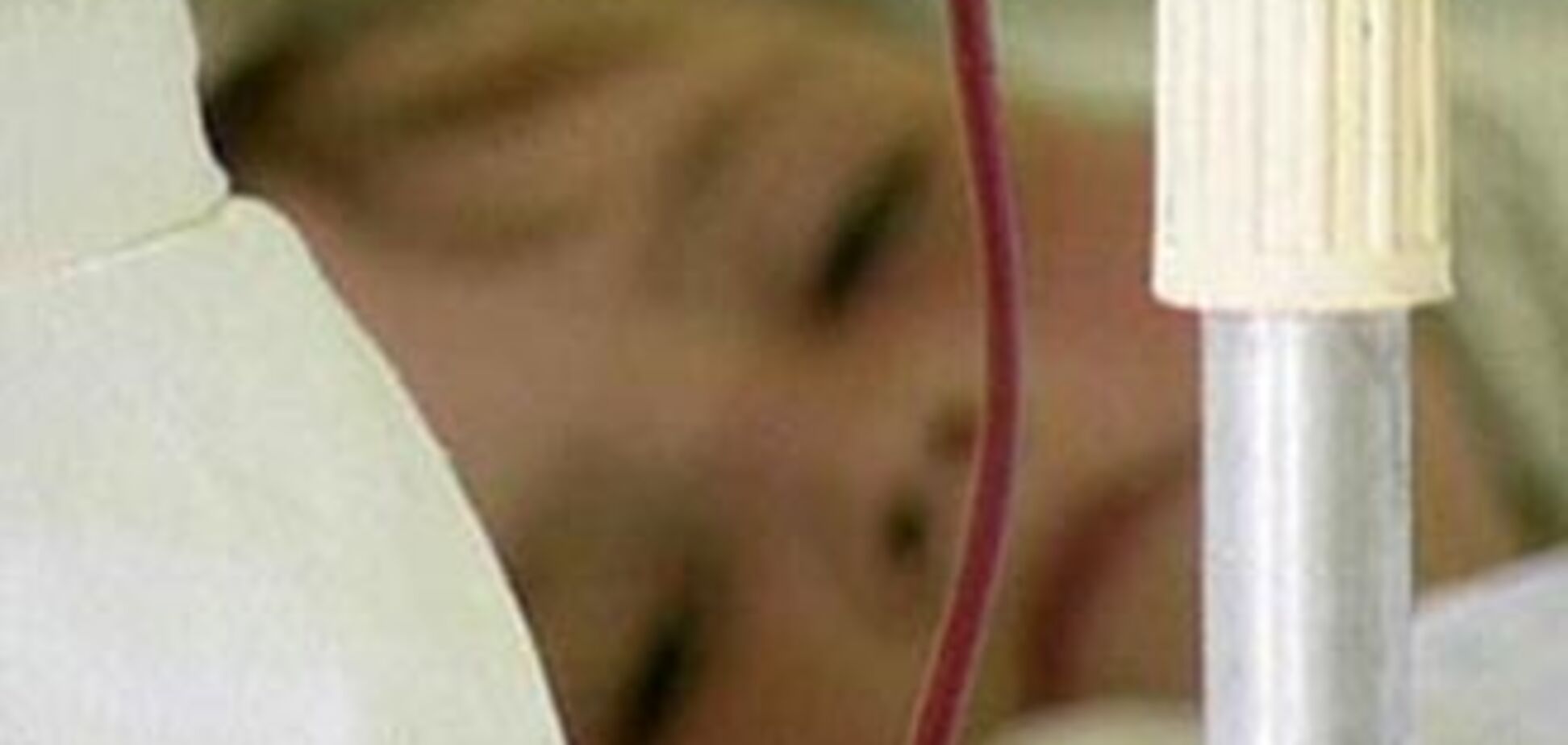 З оздоровчого комплексу госпіталізовано 35 дітей