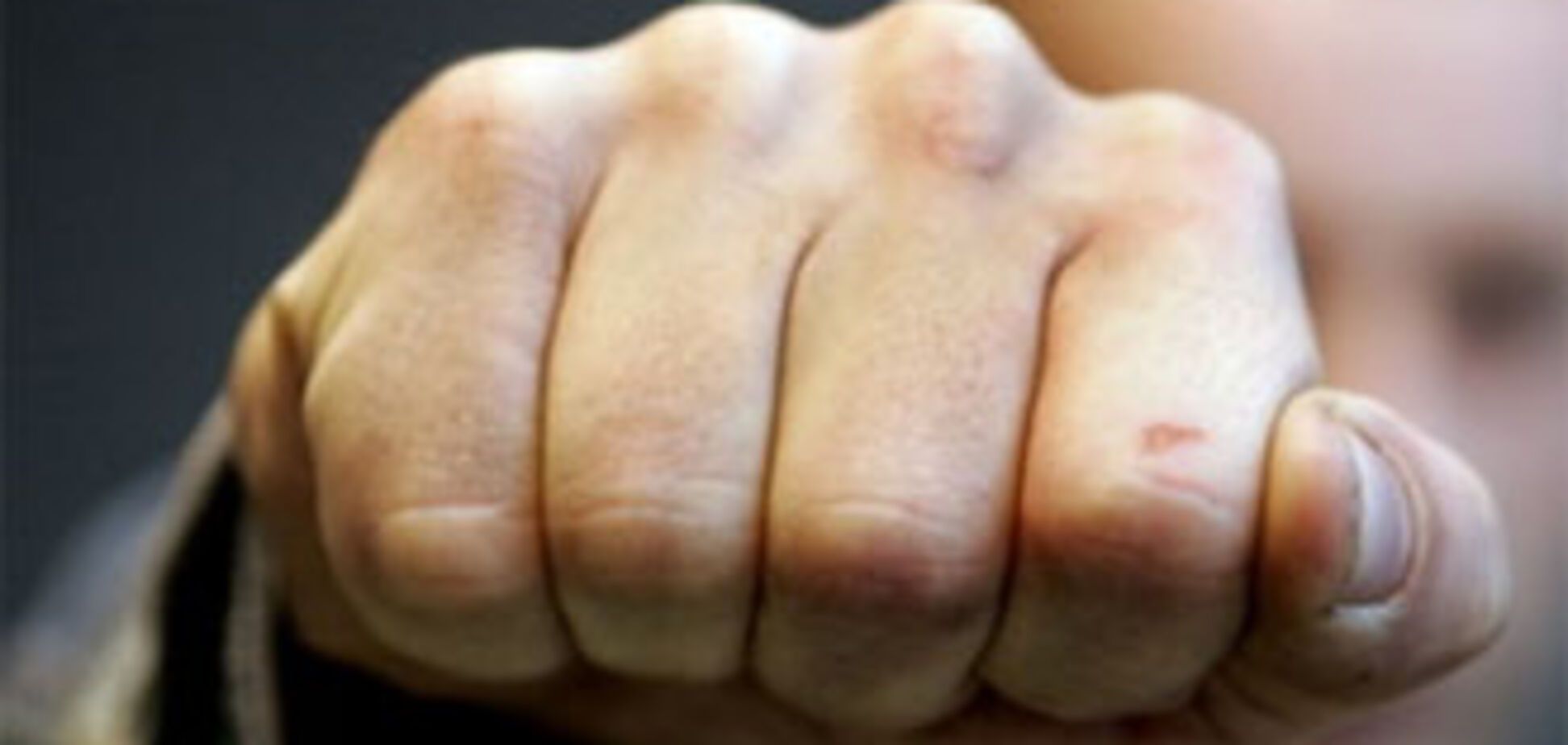 Прокурору дали по обличчю і відібрали документи