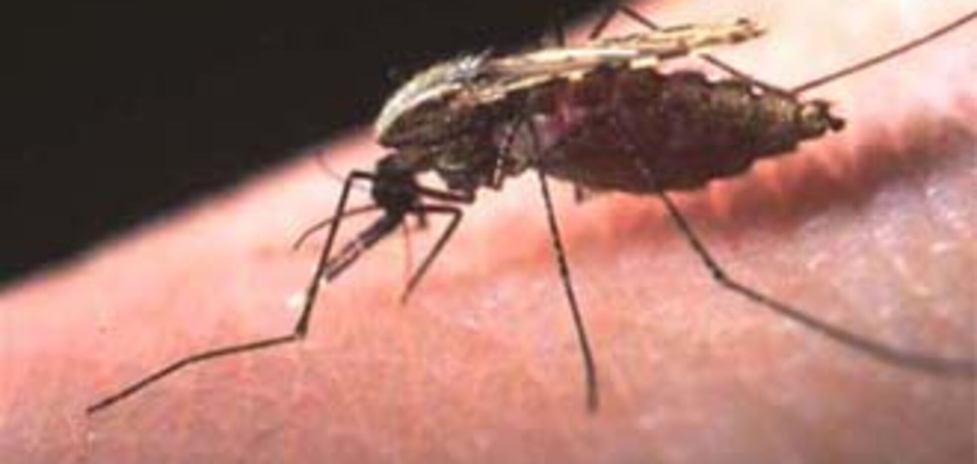 В Сумской области мужчина умер от малярии