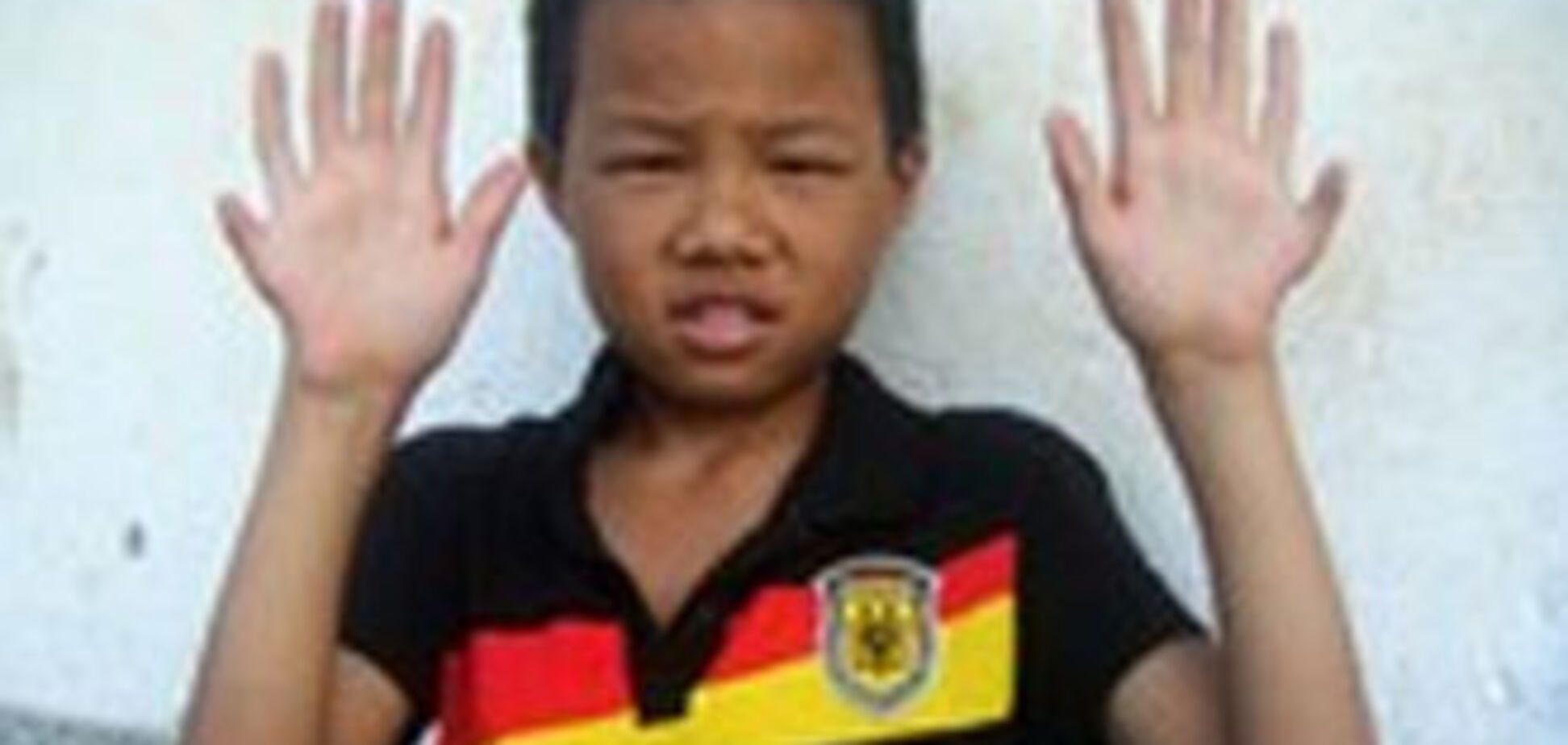 Найден мальчик с 6 пальцами на руках и ногах. ФОТО, ВИДЕО