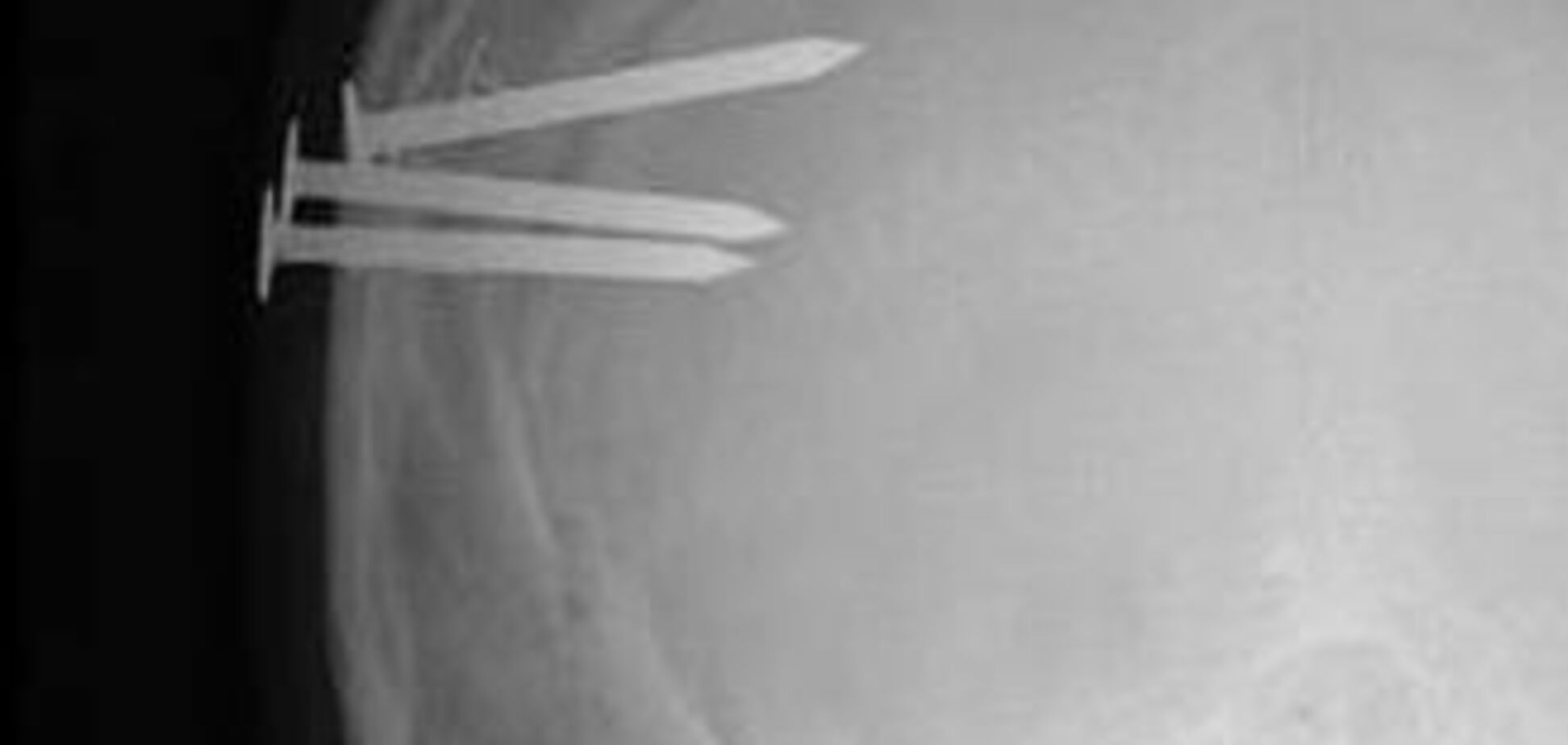 Найдивніші і дивовижні рентгенівські знімки