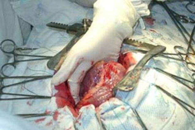 Украинские «черные врачи» еще и документы подделывали?