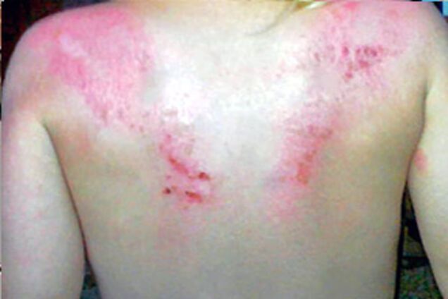 Сектанти 'вигнали біса' з трирічної дитини