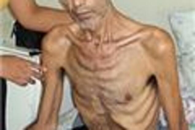 Фермер умер, голодая 5 месяцев против политики Чавеса. ФОТО