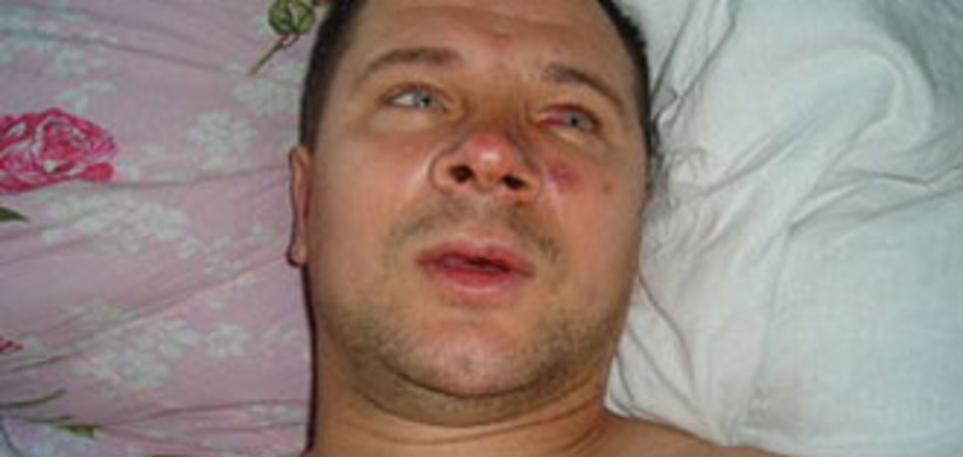 Милиционер в спину расстрелял прохожего. Жертве грозит 5 лет