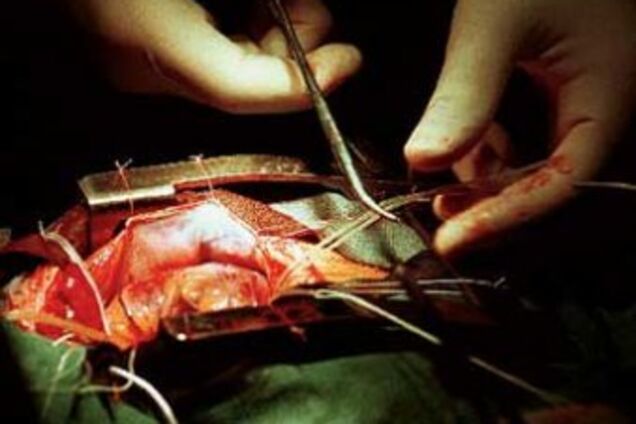 В Україні розкрита міжнародна мережа чорних хірургів