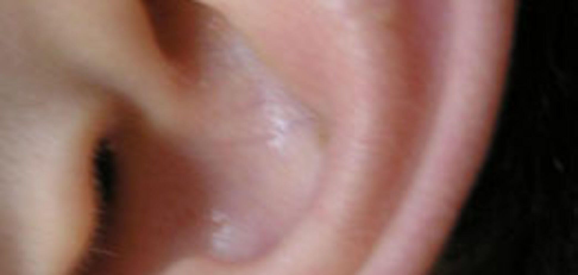 Депутата, откусившего ухо человеку, заподозрили в воровстве