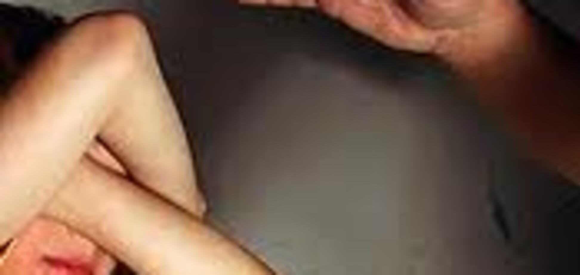 У Харкові 14-річну дівчинку намагалися згвалтувати у ліфті