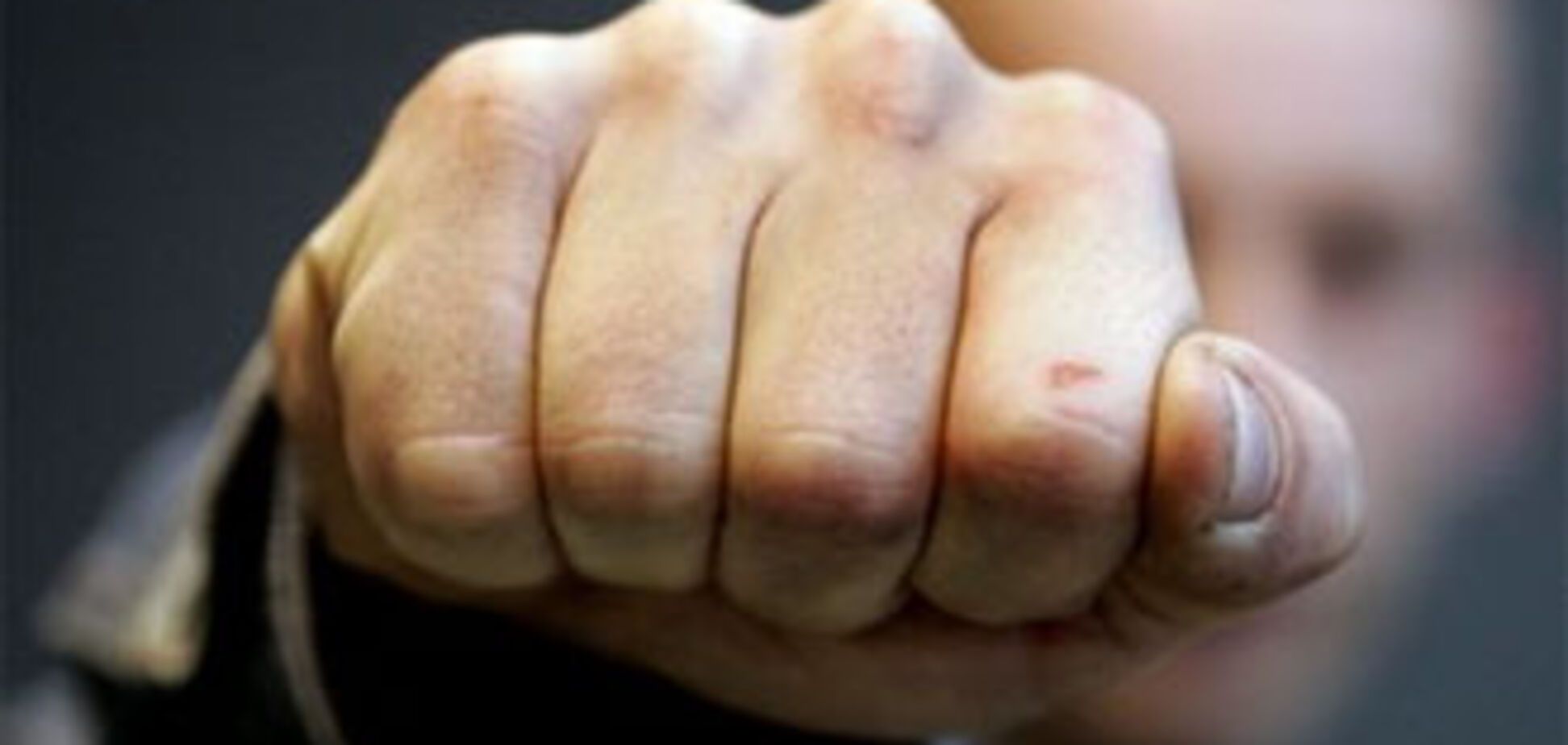 Работник центра занятости сломал инвалиду челюсть