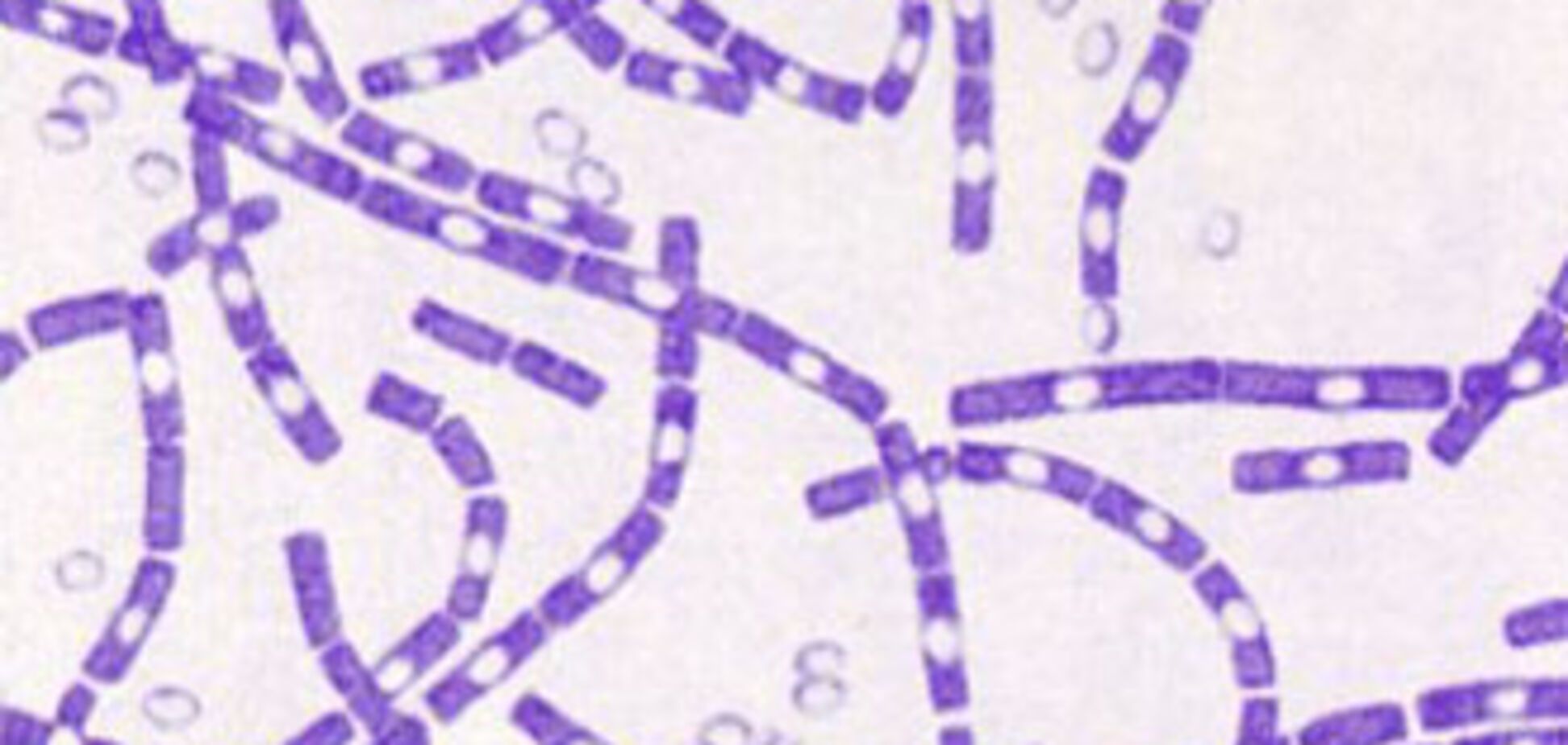 Перші жертви сибірської виразки в Україні
