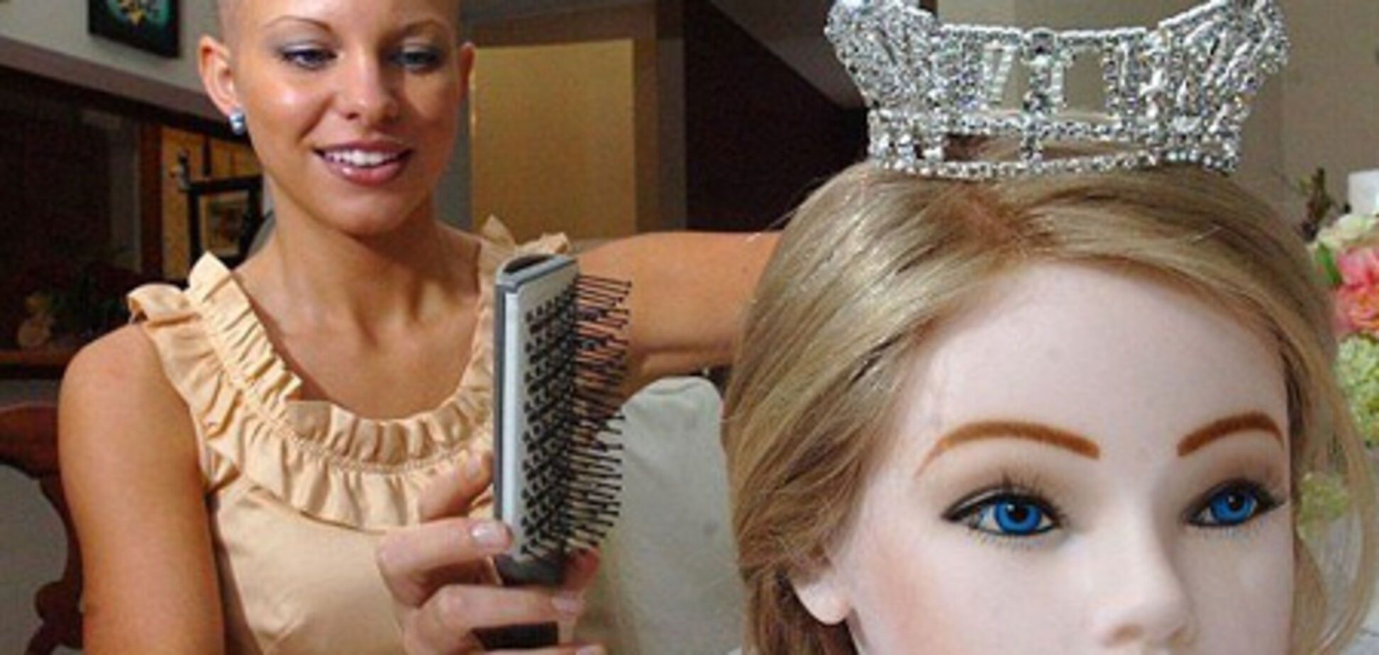 Лысая девушка стала королевой красоты. ФОТО