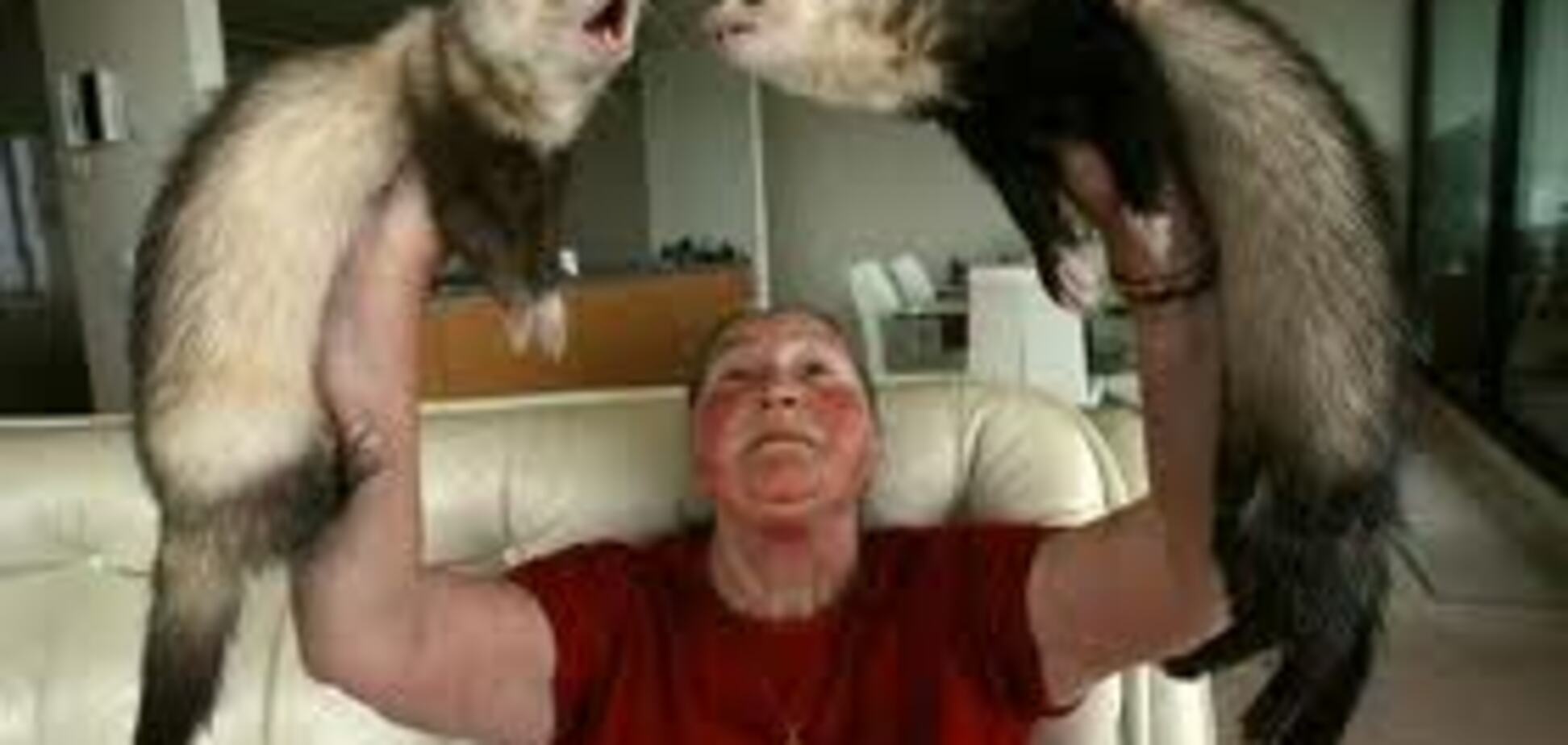 Домашний хорек отгрыз младенцу 7 пальцев