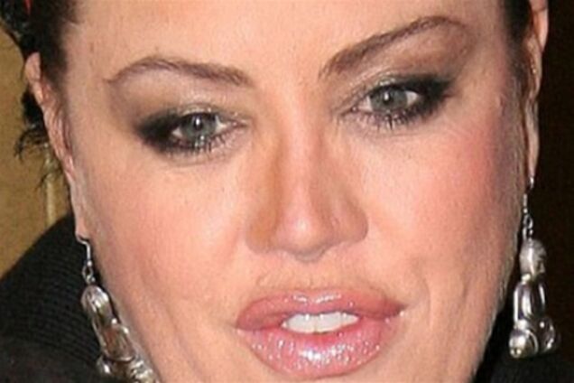 Зачем 'делают' носы звезды Украины и России?