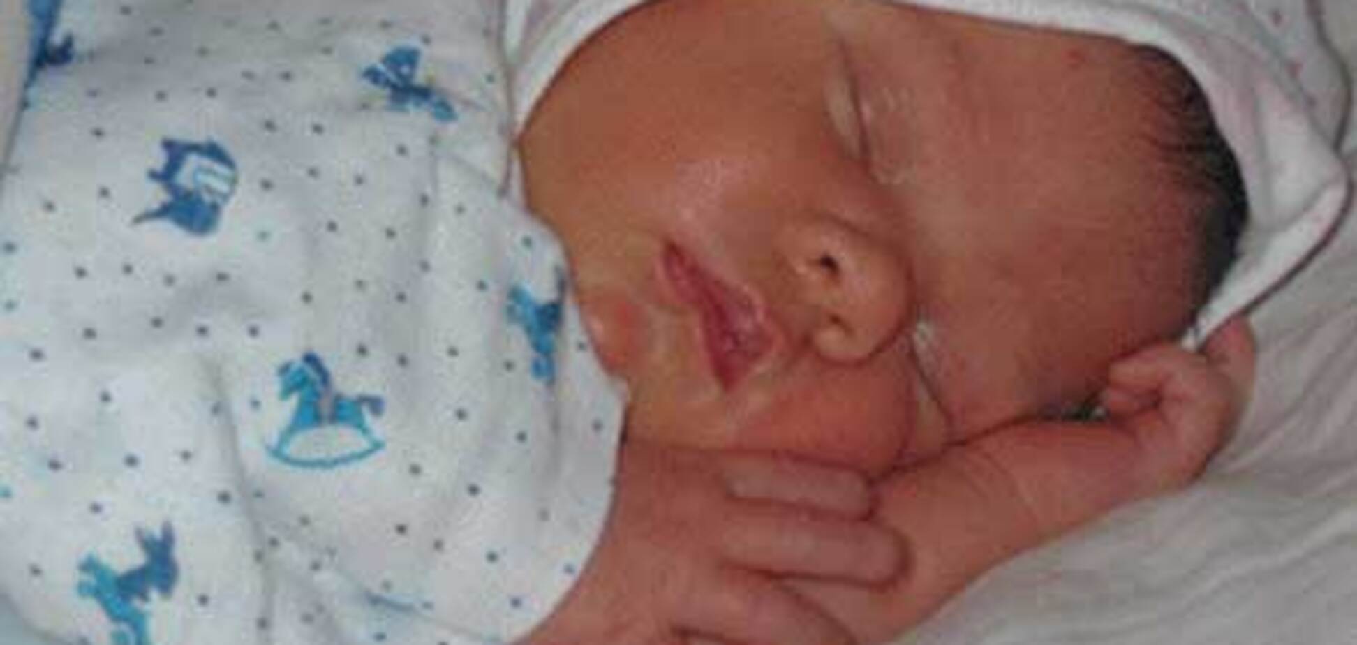 Женщина с ростом 90 см родила дочь