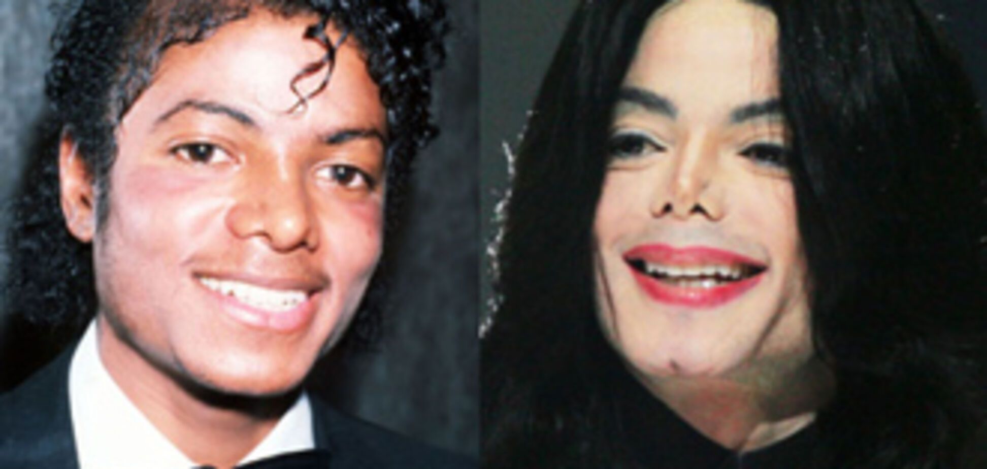 Невдалі пластичні операції знаменитостей