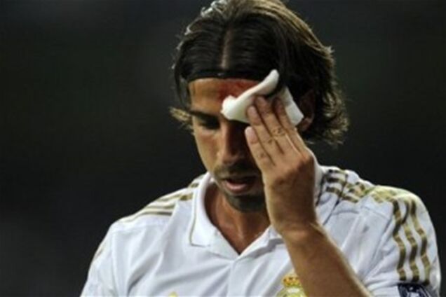 Футболист 'Реала' разбил голову одноклубнику