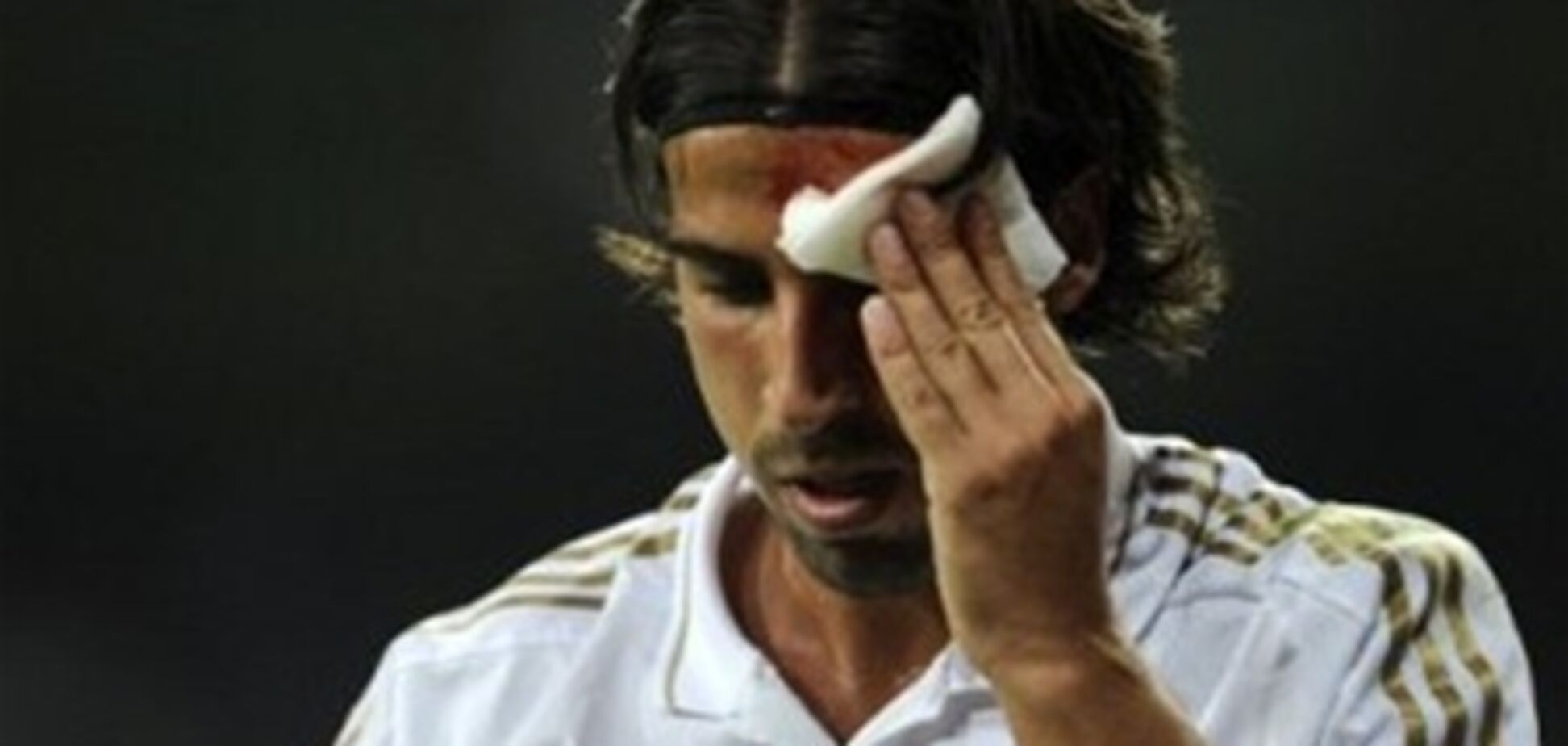 Футболист 'Реала' разбил голову одноклубнику