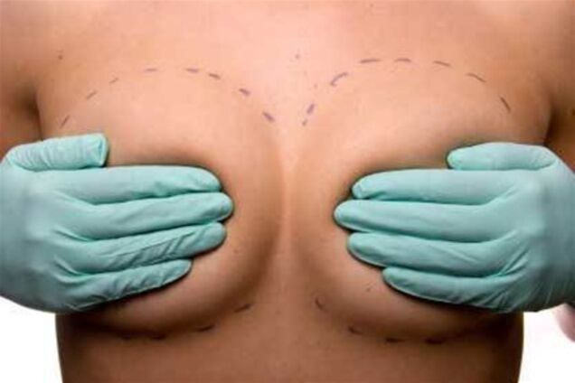 За силіконові груди британки будуть платити ще й податок