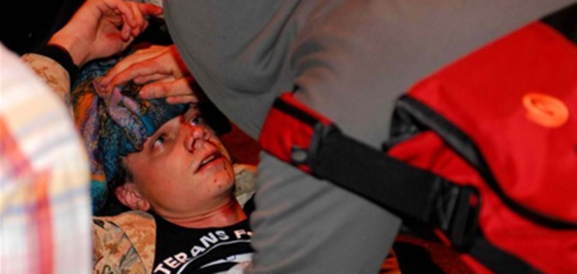 Учасник 'Захопи Уолл-Стріт' госпіталізований з переломом черепа