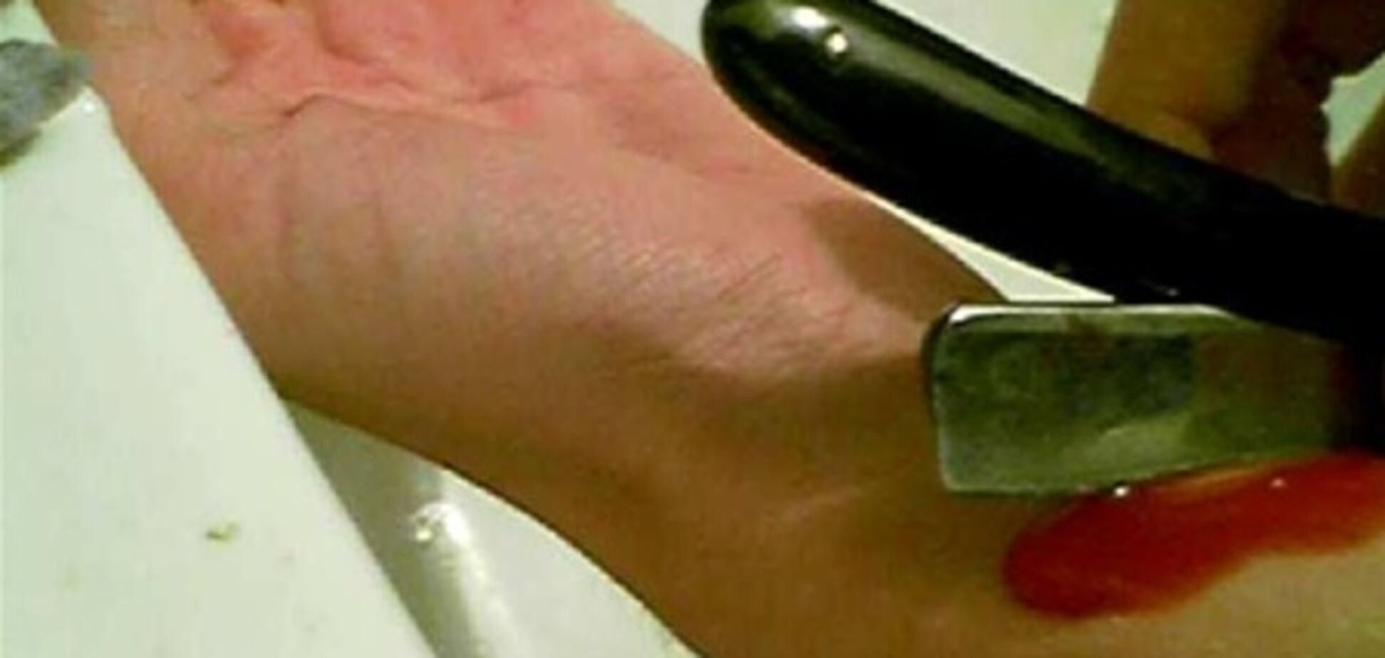 Миколаївщина. 13-річна дівчинка порізала собі вени прямо в школі