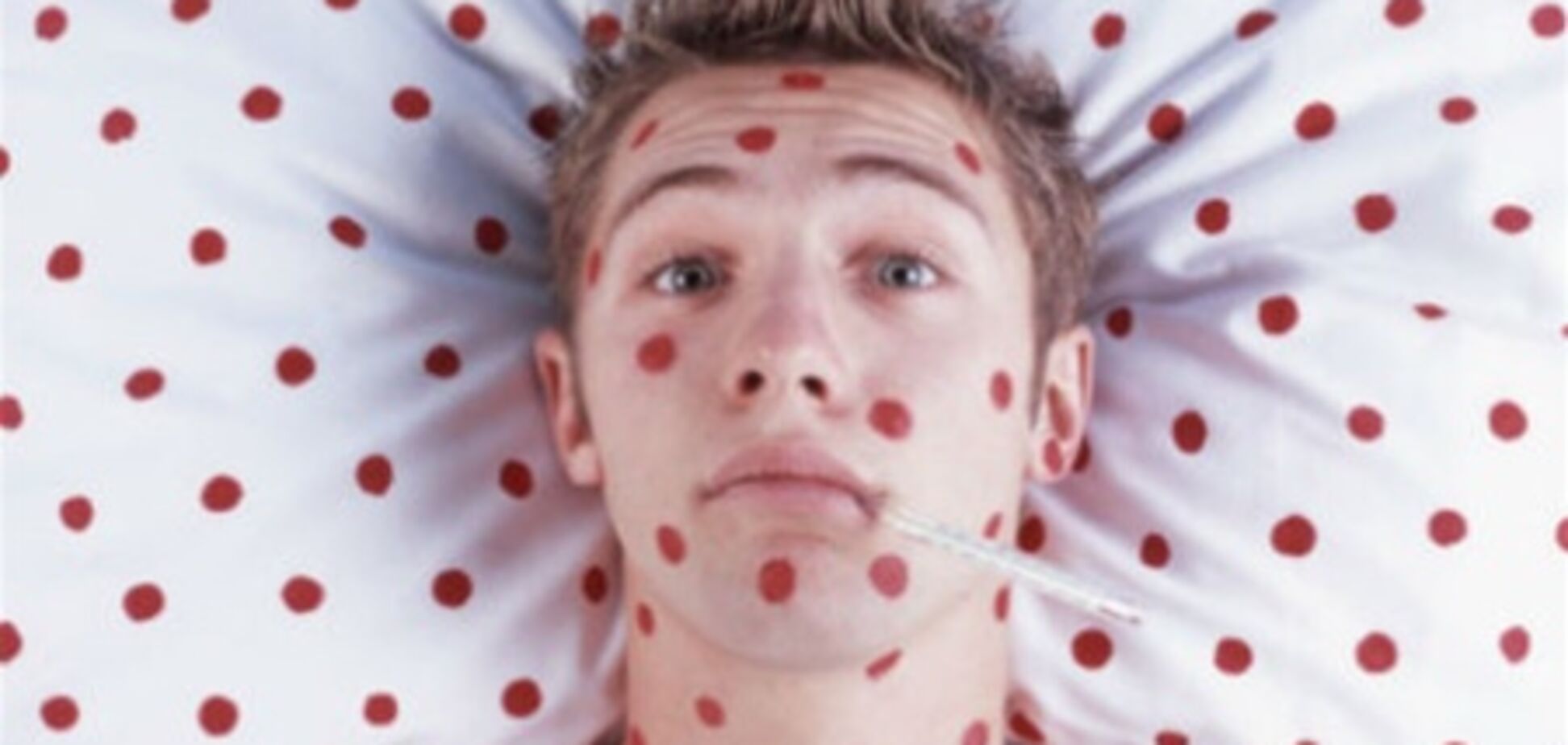 Івано-Франківщина. Кількість хворих на кір перевалила за півтори сотні