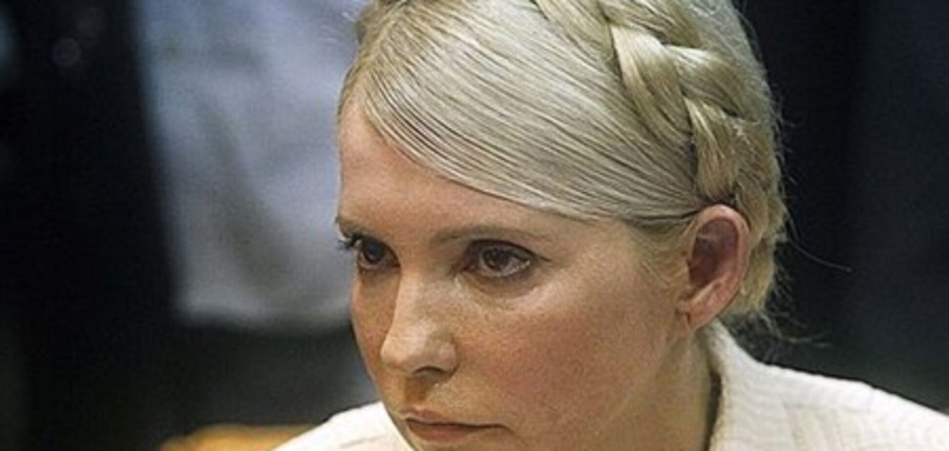 Синці Тимошенко викликають багато питань - Поліщук