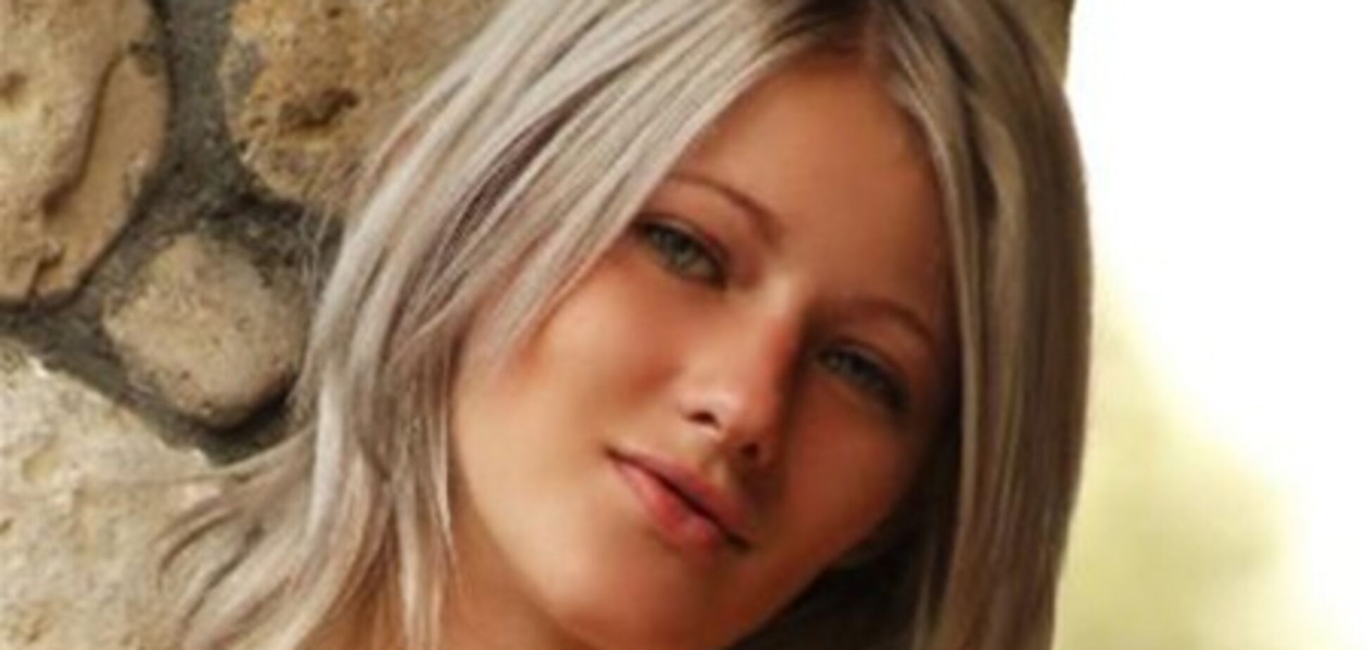 Виявлені у жертви Ландика симптоми характерні не тільки для струсу мозку - невропатолог