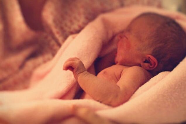 В Украине все чаще рождаются дети с 'волчьей пастью'