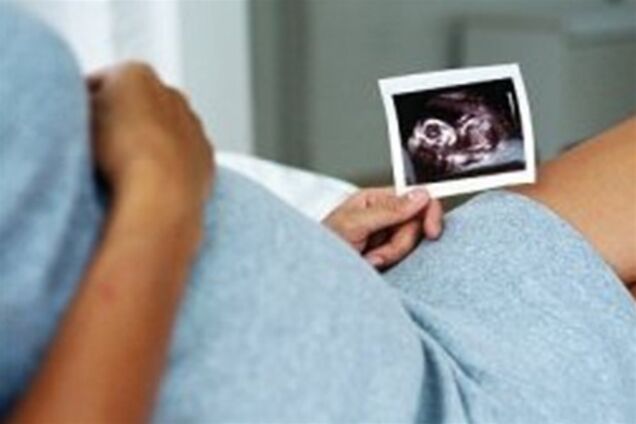 Народження мертвих дітей можна запобігти