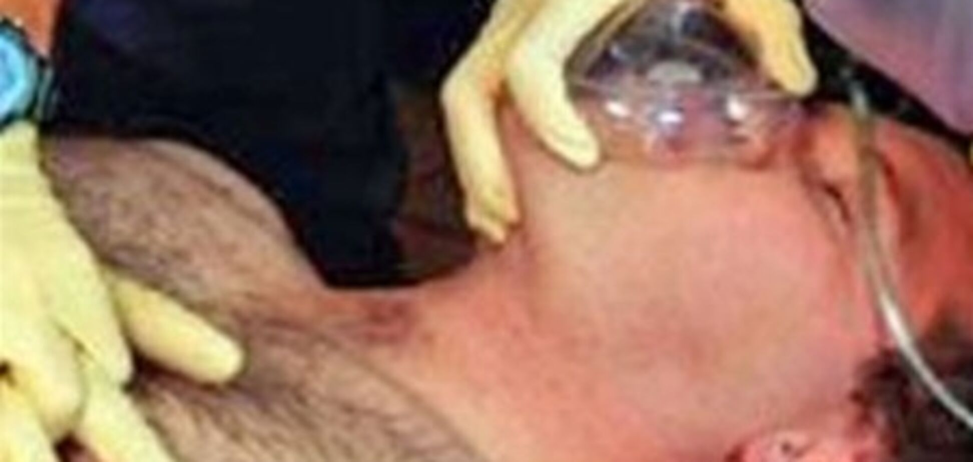 Чадний газ: вбивця закоханих і сплячих