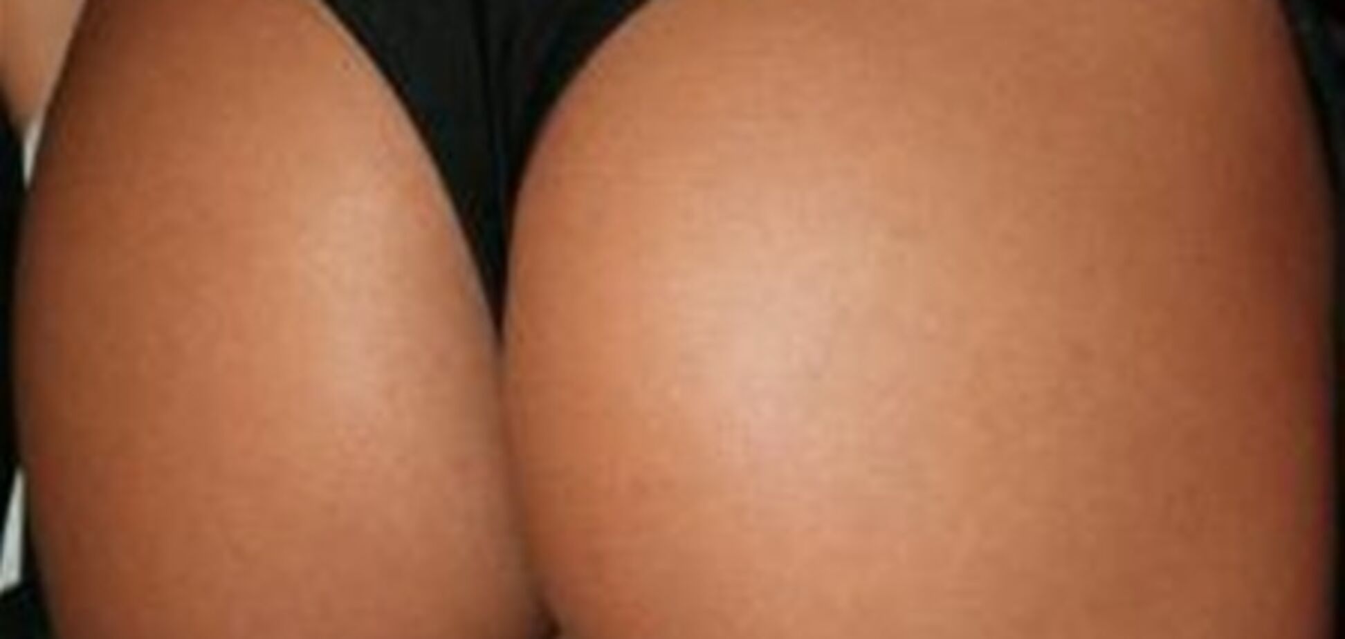 Померти від силіконової краси