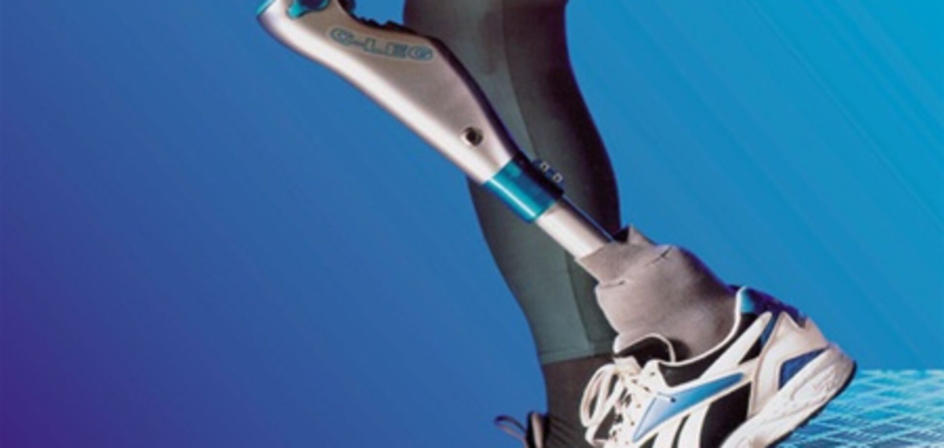 У чоловіка вкрали ногу