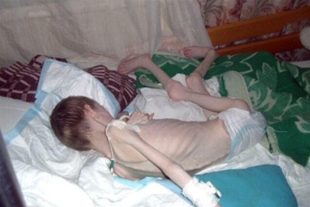 Запорізький чиновник наживався на дітях-інвалідах