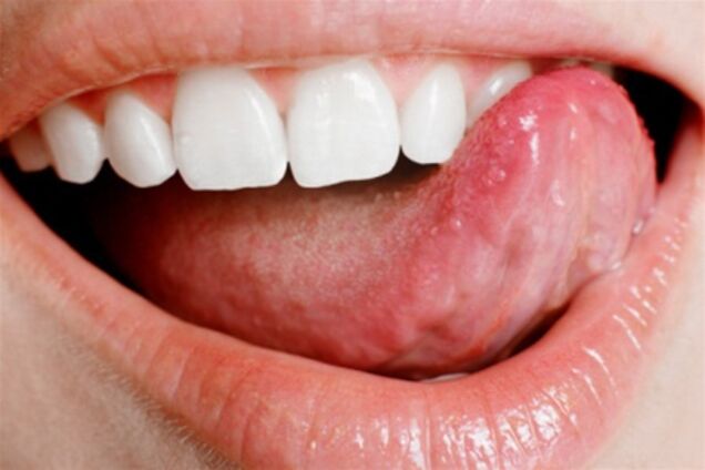 Чищення язика обов'язкове для здоров'я