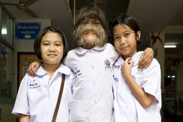 Самая волосатая девочка в мире попала в Книгу Гиннесса. Фото