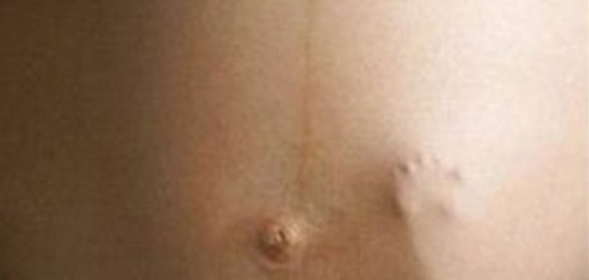 Аборт безопаснее родов