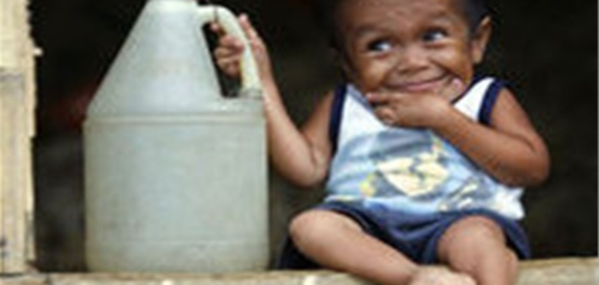 Самый маленький человек - ростом с канистру. Фото