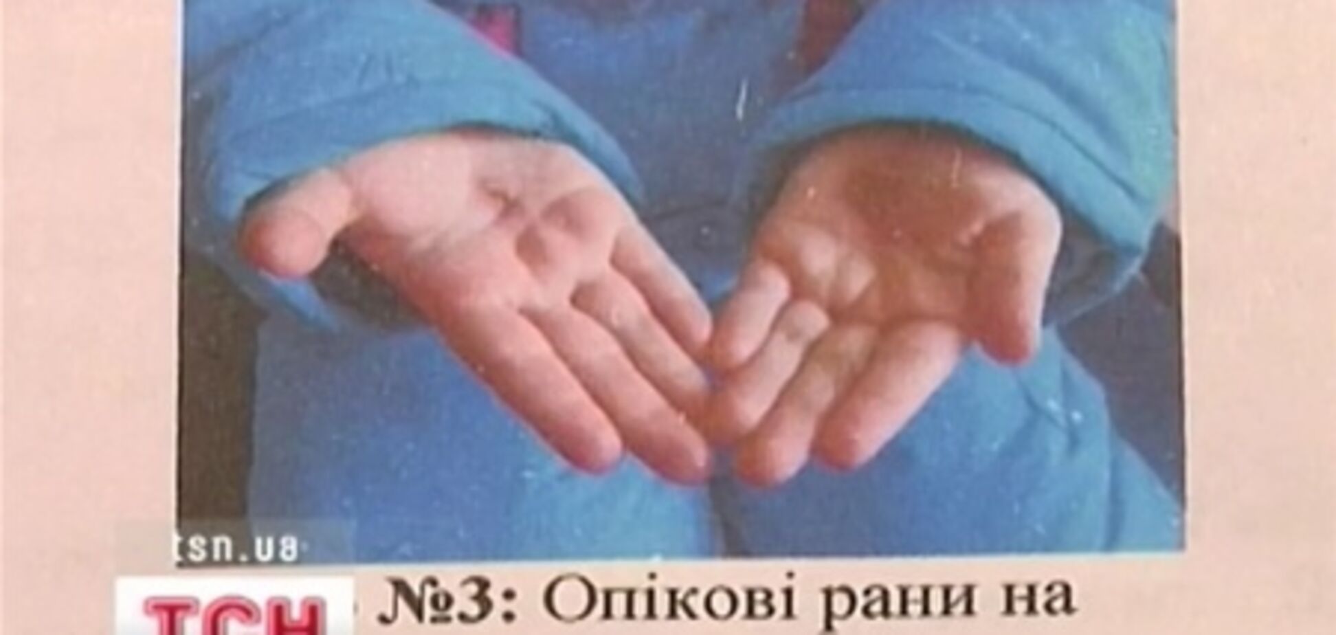 На Дніпропетровщині прийомна матір катувала дітей розпеченим залізом
