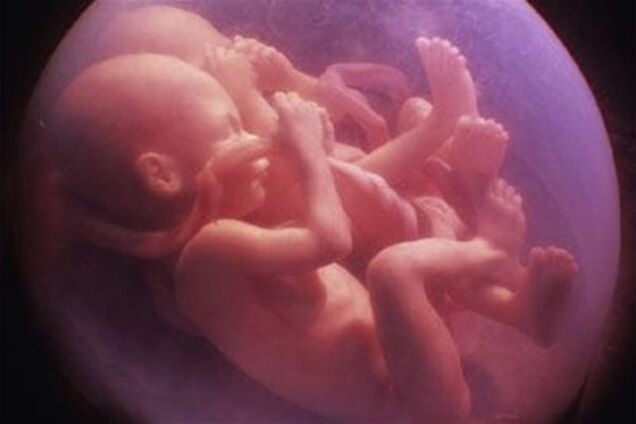 Чорнобильська радіація накопичується в хребцях ще не народжених дітей