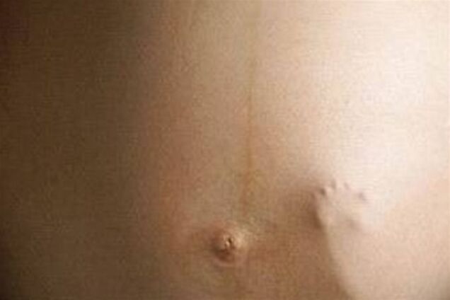 Какие женщины чаще всего теряют детей