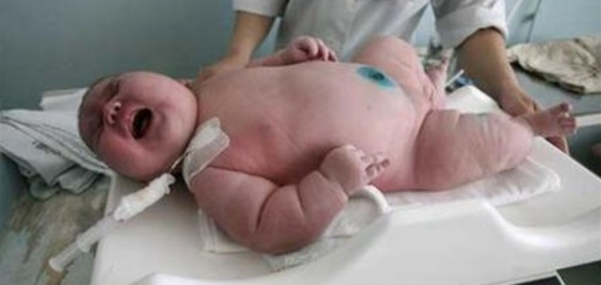В Болгарии женщина родила ребенка-гиганта. Фото